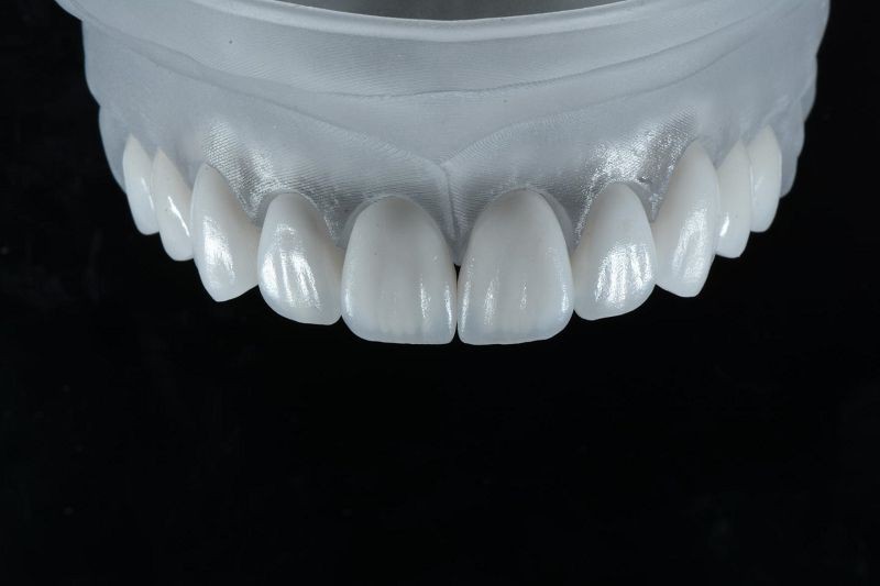 Multilayered Zirconia