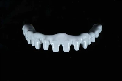 1600MPaジルコニアバーブリッジ